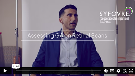 Video thumbnail: Assessing GA on Retinal Scans